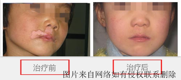 综Ƥô
