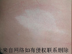 综߶ô