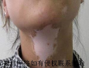 综ճλ