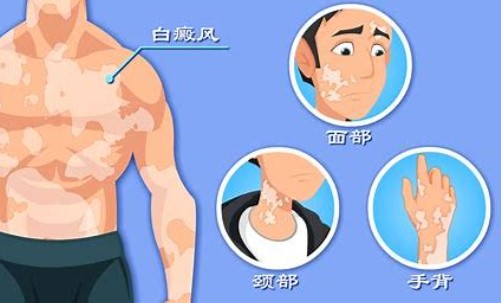 粡ӷΣ